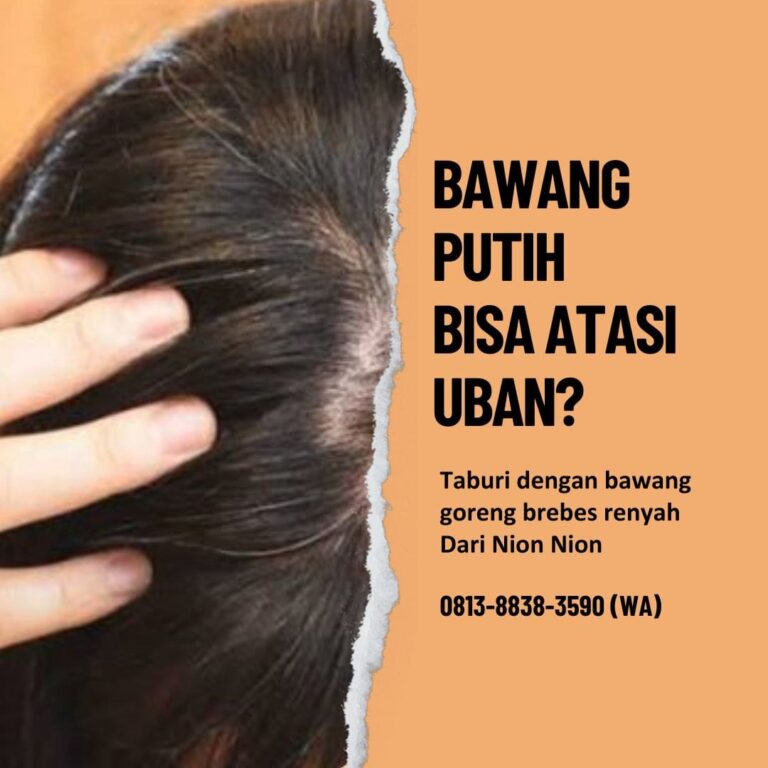 Manfaat Bawang Putih untuk Rambut - Nion Nion (5)
